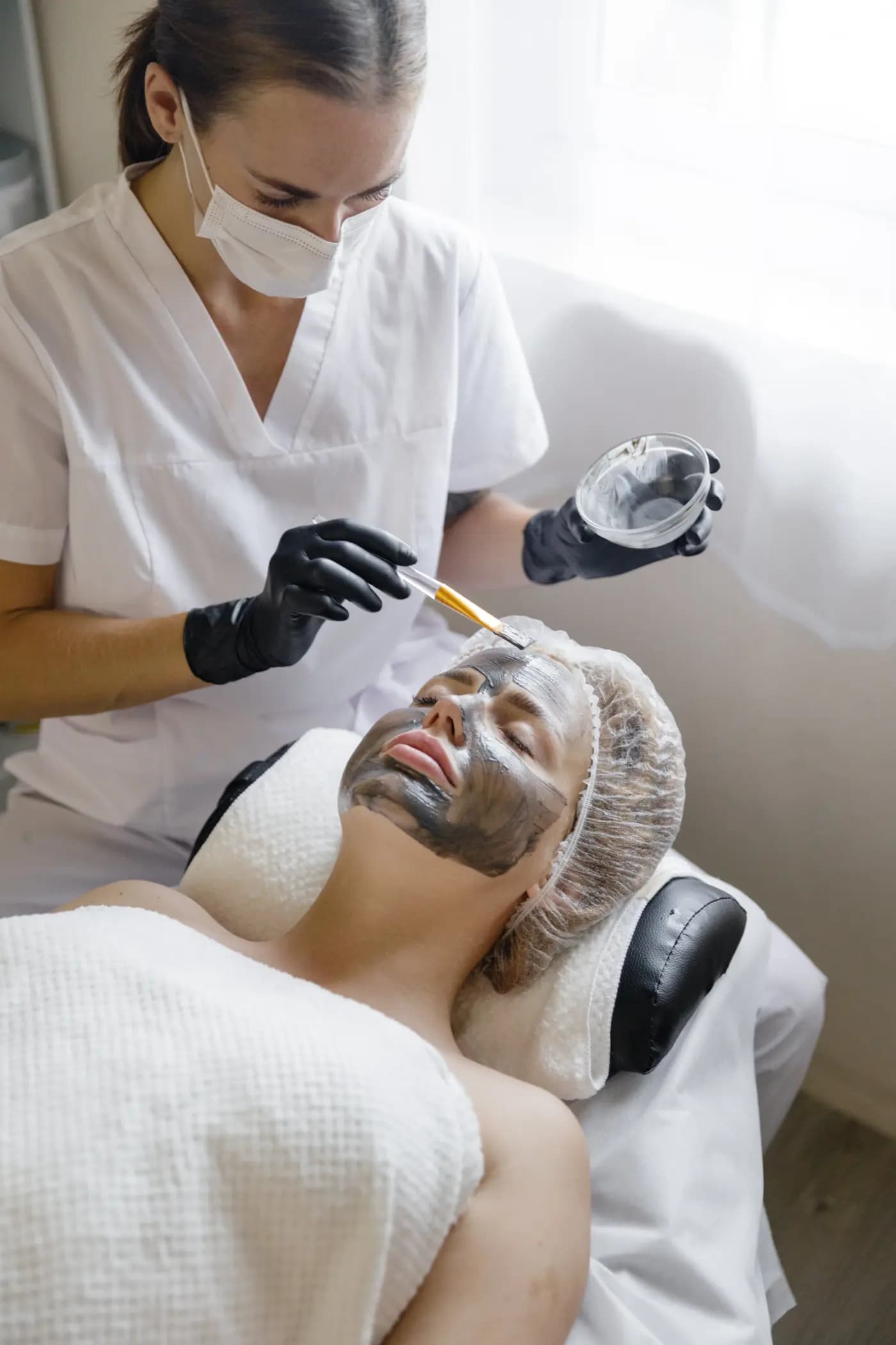 Face SMAS lifting — After